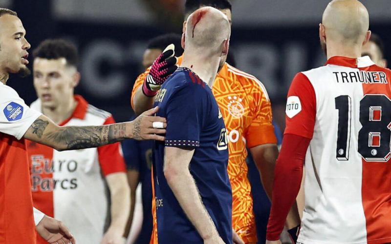 В Голландии футболисту разбили голову зажигалкой во время матча. Видео